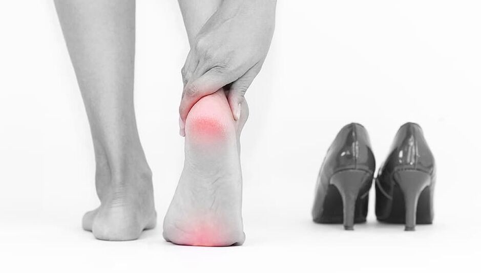 Wearing tight shoes is the cause of mycosis.