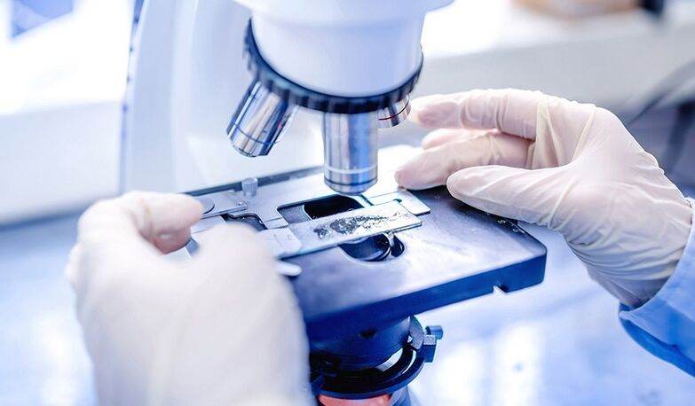 laboratory diagnosis of toenail fungus