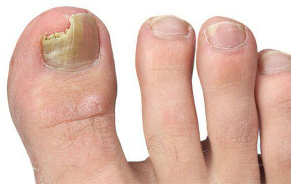 Various forms of fungi