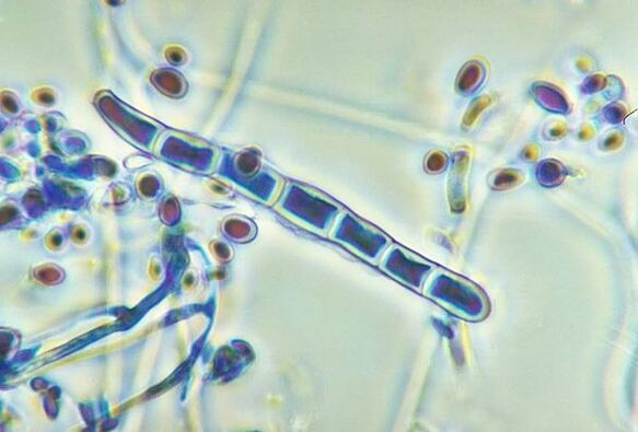 Trichophyton rubrum fungus under a microscope