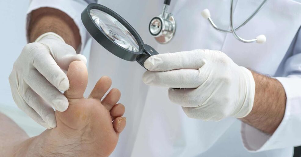 The doctor examines the feet for fungus.